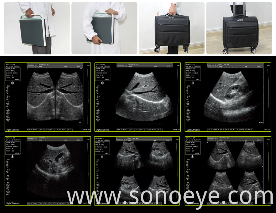 Digital Trolley Ultrasound Scanner